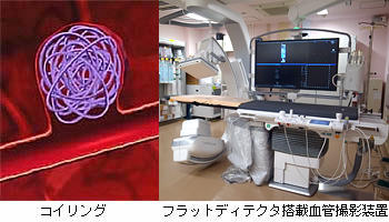 フラットディテクタ搭載血管撮影装置