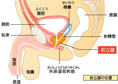 前立腺癌