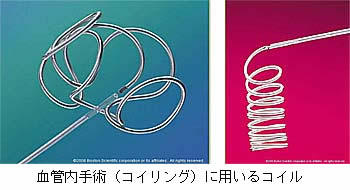 血管内手術(コイリング)に用いるコイル