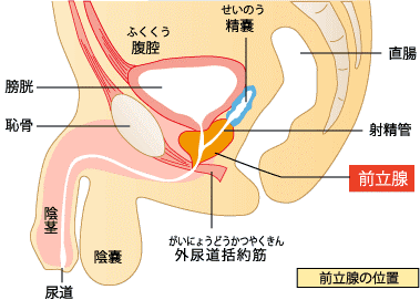 前立腺がん