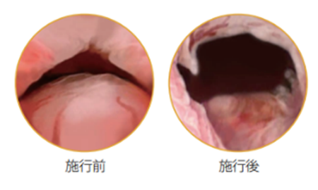 手術詳細