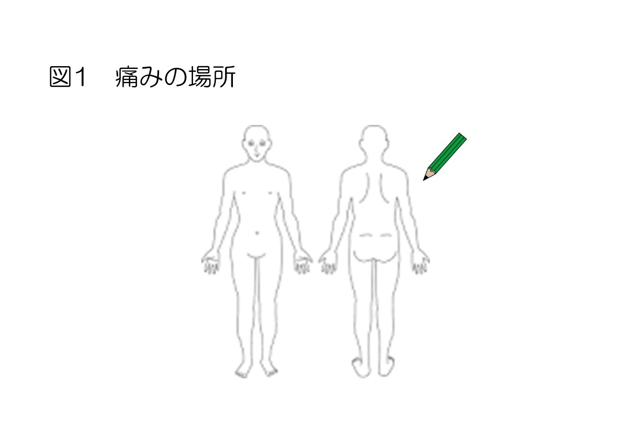 図1　痛みの場所（人体の前・後）