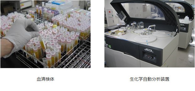 生化学検査