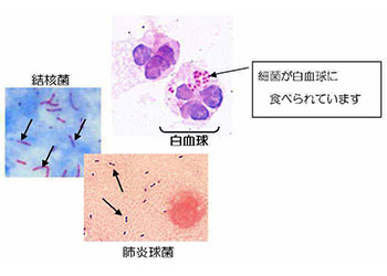 細菌検査イメージ