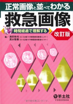 書籍「正常画像と並べてわかる救急画像 改訂版~時間経過で理解する」の表紙