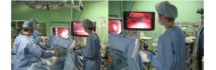 胃粘膜下腫瘍に対する腹腔鏡・内視鏡合同手術イメージ